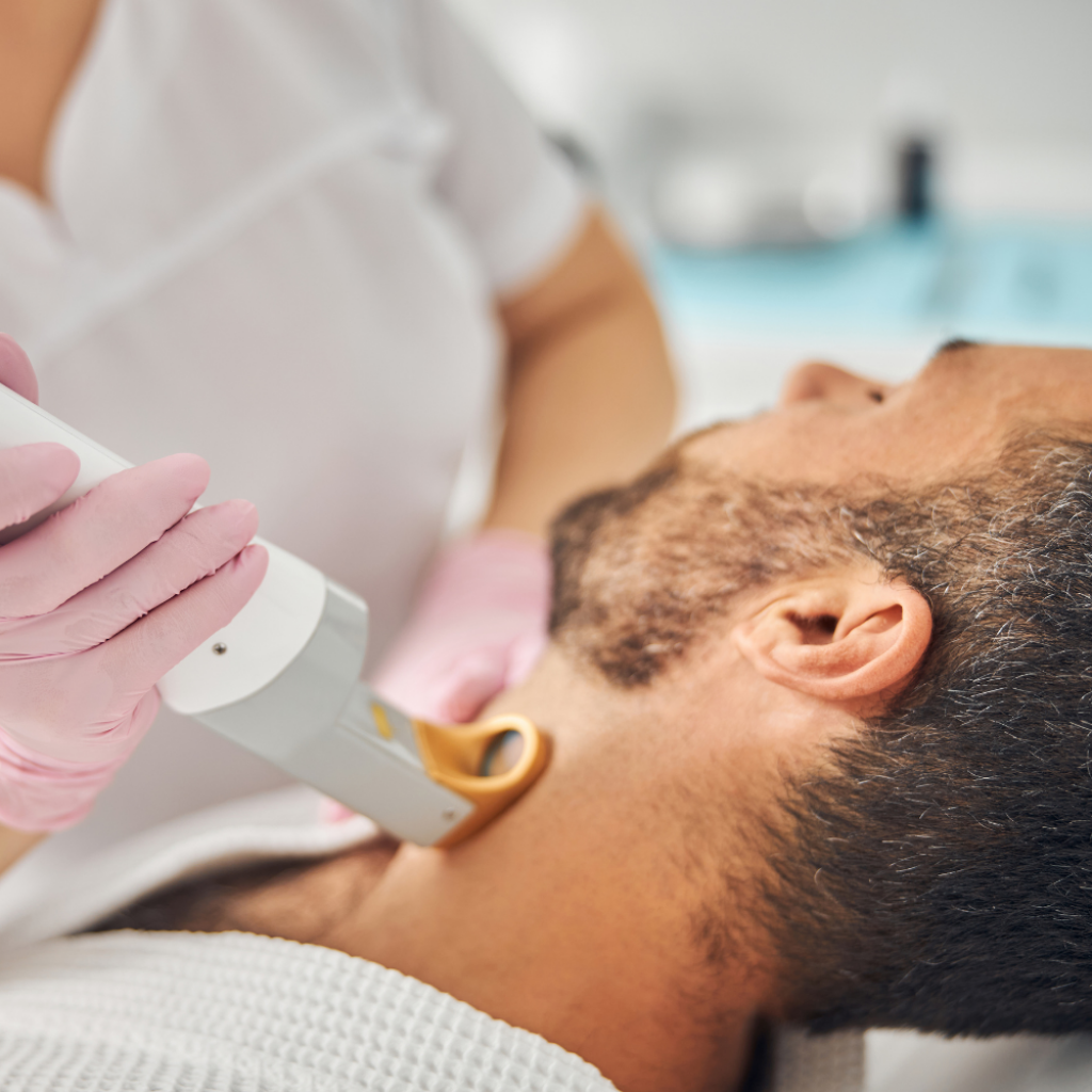 Dauerhafte Haarentfernung n Männern mittels Lasertechnik.